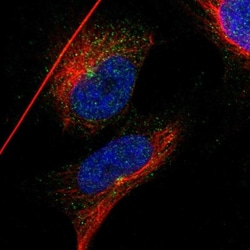 IFT81 Antibody, Novus Biologicals:Antibodies:Primary Antibodies